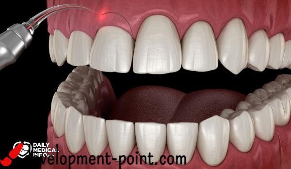 Cut the gums