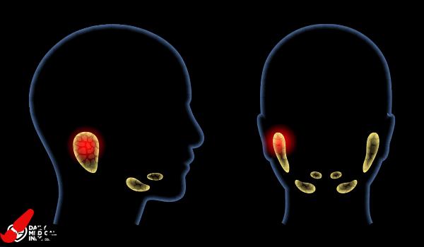 gland-parotid