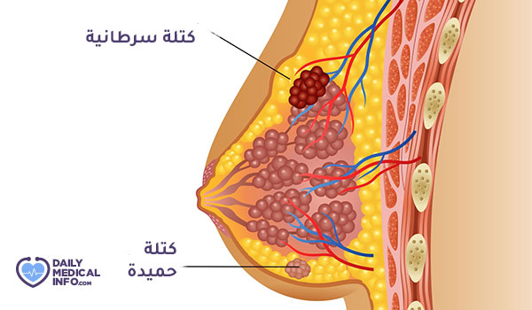 Breast cancer pill shape pictures