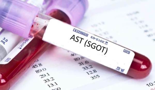 AST analysis