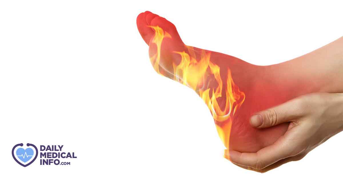 Causes of hot feet