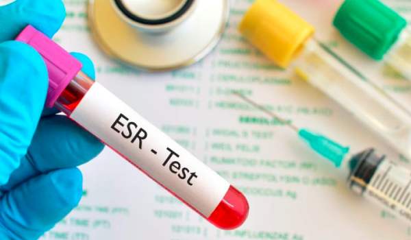 ESR analysis