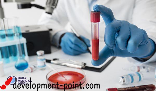 Ferritin analysis
