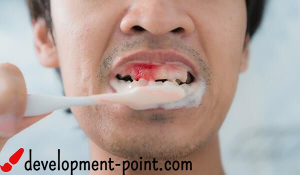 Inflammation of the teeth and gums