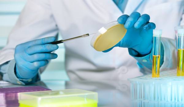 urine culture