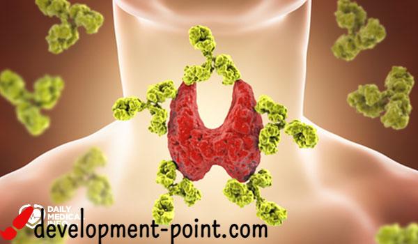 Causes of hypothyroidism and are you exposed to it?